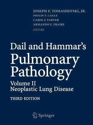 Dail and Hammar's Pulmonary Pathology: Volume II: Neoplastic Lung Disease by Tomashefski, Joseph F.