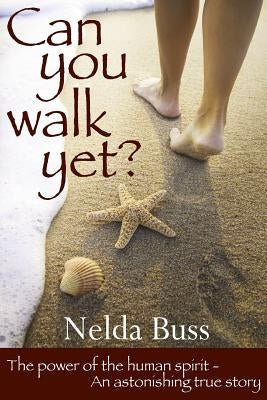 Can You Walk Yet? by Buss, Nelda