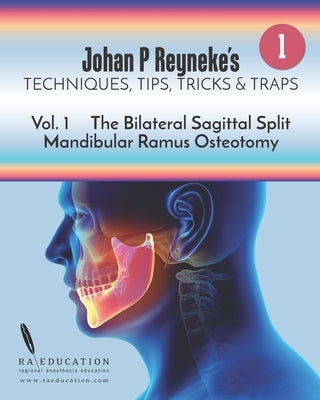 Johan P Reyneke's Techniques, Tips, Tricks and Traps: Volume 1: The Bilateral Sagittal Split Mandibular Ramus Osteotomy by Reyneke, Johan P.