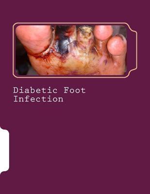 Diabetic Foot Infection by Raza, Syed Shahmeer