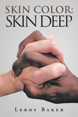 Skin Color: Skin Deep by Baker, Leroy