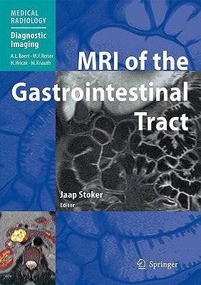MRI of the Gastrointestinal Tract by Stoker, Jaap