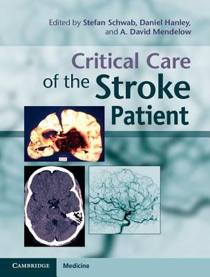 Critical Care of the Stroke Patient by Schwab, Stefan