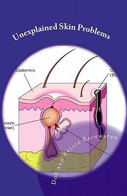 Unexplained Skin Problems: Home Treatment And Precautions by Rainwater, Don