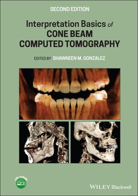 Interpretation Basics of Cone Beam Computed Tomography by Gonzalez, Shawneen M.