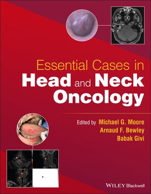 Essential Cases in Head and Neck Oncology by Moore, Michael G.