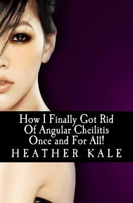 How I Finally Got Rid Of Angular Cheilitis Once and For All!: Cracked Mouth Corners No More by Ortiz, Petra