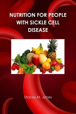 Nutrition for people with Sickle Cell Disease by Jones, Stacey