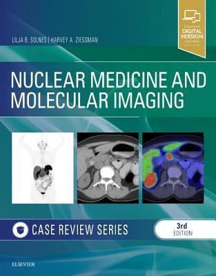 Nuclear Medicine and Molecular Imaging: Case Review Series by Solnes, Lilja B.