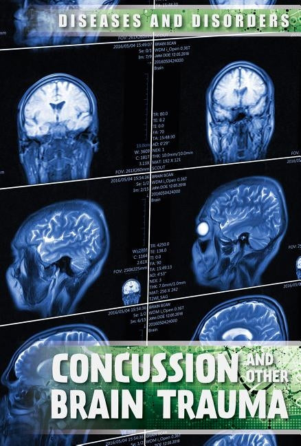 Concussions and Other Brain Trauma by Nagelhout, Ryan
