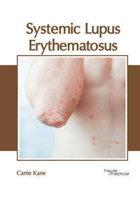 Systemic Lupus Erythematosus by Kane, Carrie