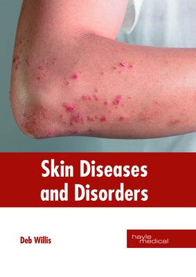 Skin Diseases and Disorders by Willis, Deb