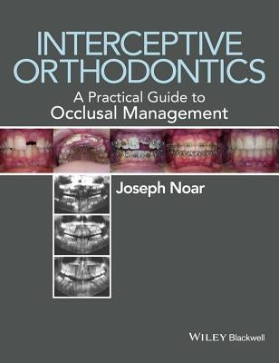 Interceptive Orthodontics: A Practical Guide to Occlusal Management by Noar, Joseph