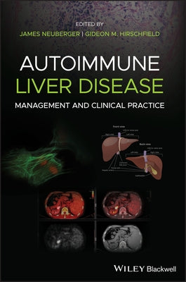 Autoimmune Liver Disease: Management and Clinical Practice by Neuberger, James
