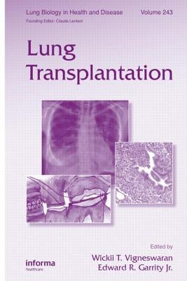 Lung Transplantation by Vigneswaran, Wickii