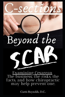 C-sections: Beyond the Scar: Examining Cesarean by Reynolds, Curtis M.