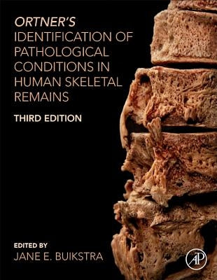 Ortner's Identification of Pathological Conditions in Human Skeletal Remains by Buikstra, Jane