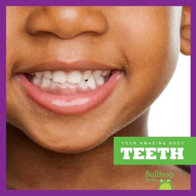 Teeth by Kingsley, Imogen