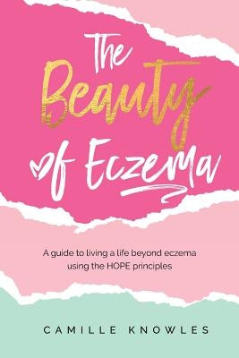 The Beauty of Eczema: A Guide To Living a Life Beyond Eczema Using The Hope Principles by Knowles, Camille