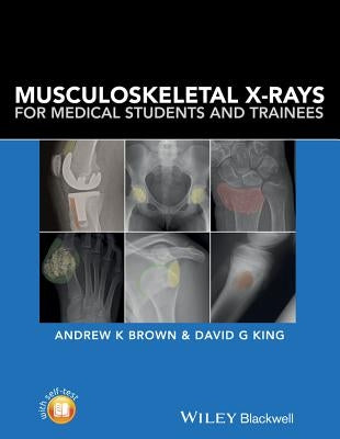 Musculoskeletal X-Rays for Medical Students and Trainees by Brown, Andrew