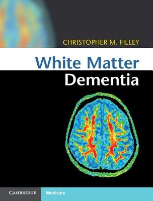 White Matter Dementia by Filley, Christopher M.