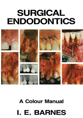 Surgical Endodontics: A Colour Manual by Barnes, I.