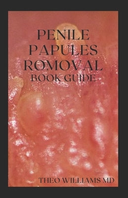 Penile Papules Romoval Book Guide: The Ultimate Guide On How To Remove Pearly Penile Papules Using Natural Remedies by Williams, Theo