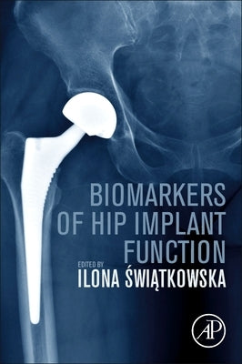 Biomarkers of Hip Implant Function by Swiatkowska, Ilona