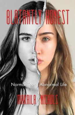 Blatantly Honest: Normal Teen, Abnormal Life by Nichols, Makaila