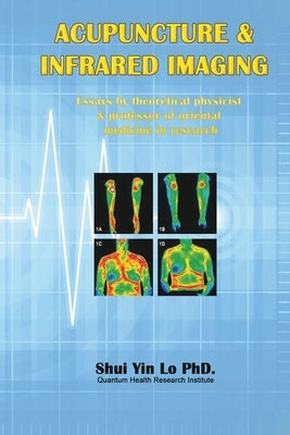 Acupuncture and Infrared Imaging: Essays by theoretical physicist & professor of oriental medicine in research by Lo, Shui Yin
