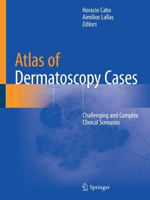 Atlas of Dermatoscopy Cases: Challenging and Complex Clinical Scenarios by Cabo, Horacio