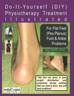 Physiotherapy Treatment Illustrated For Flat Feet (Pes Planus) Foot & Ankle Problems by Ims, Iriz