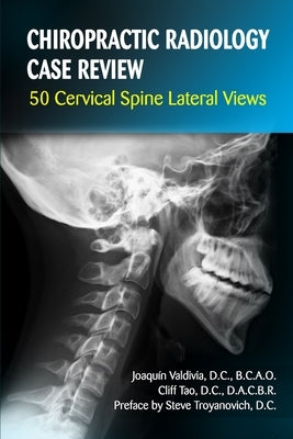 Chiropractic Radiology Case Review: 50 Cervical Spine Lateral Views by Tao, Cliff
