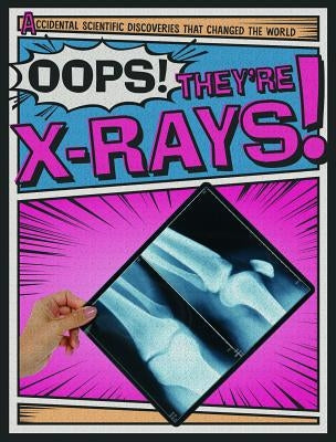 Oops! They're X-Rays! by Wojtan, Nick