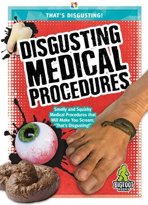 Disgusting Medical Procedures by Mattern, Joanne